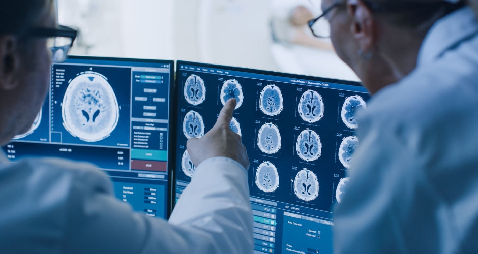 Doctors looking at a brain scan